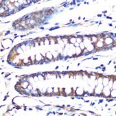 Anti-Aromatase (CYP19A1) Antibody, clone 5C5N7, Rabbit Monoclonal