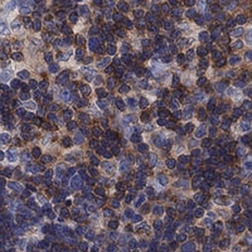 Anti-PSD4 antibody produced in rabbit Prestige Antibodies&#174; Powered by Atlas Antibodies, affinity isolated antibody, buffered aqueous glycerol solution