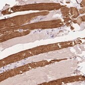 Anti-TNNT3 antibody produced in rabbit Prestige Antibodies&#174; Powered by Atlas Antibodies, affinity isolated antibody, buffered aqueous glycerol solution