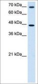 Anti-GABRP antibody produced in rabbit affinity isolated antibody