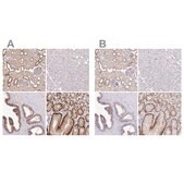 Anti-SLC9A1 antibody produced in rabbit Prestige Antibodies&#174; Powered by Atlas Antibodies, affinity isolated antibody, buffered aqueous glycerol solution