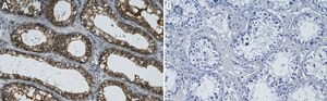 Anti-&#946; Tubulin Antibody, clone AA2 ZooMAb&#174; Mouse Monoclonal recombinant, expressed in HEK 293 cells