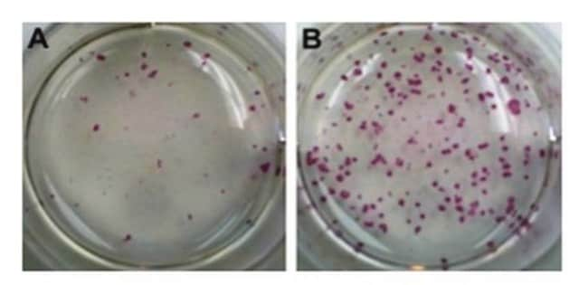 Mouse iPS Reprogramming Boost Supplement The Mouse iPS Reprogramming Boost Supplement enhances the efficiency of mouse iPS colony formation by at least 3-fold.