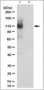 Anti-TEL-AML1 fusion Antibody, clone 6F2