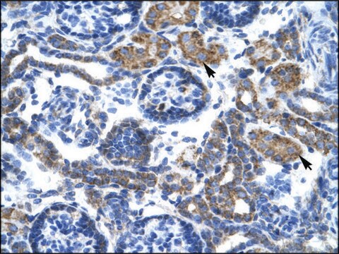 Anti-C4BPB antibody produced in rabbit affinity isolated antibody