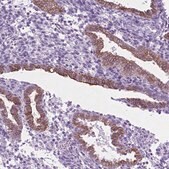 Anti-HTR2B antibody produced in rabbit Prestige Antibodies&#174; Powered by Atlas Antibodies, affinity isolated antibody, buffered aqueous glycerol solution