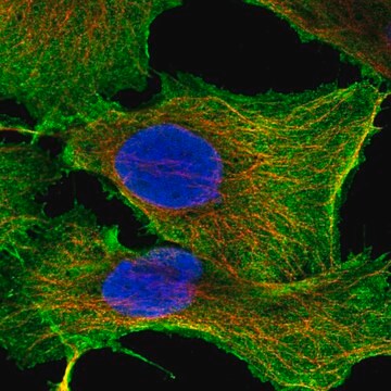 Anti-Sdc2 Antibody Produced In Rabbit Prestige Antibodies&#174; Powered by Atlas Antibodies, affinity isolated antibody, buffered aqueous glycerol solution