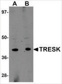 Anti-TRESK antibody produced in rabbit affinity isolated antibody, buffered aqueous solution