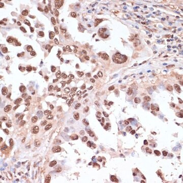 Anti- ITCH antibody produced in rabbit