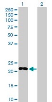 Anti-PDE4DIP antibody produced in rabbit purified immunoglobulin, buffered aqueous solution