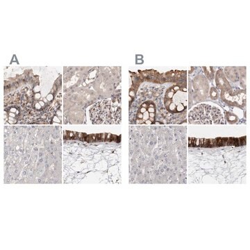 Anti-UFC1 antibody produced in rabbit Prestige Antibodies&#174; Powered by Atlas Antibodies, affinity isolated antibody, buffered aqueous glycerol solution, ab2