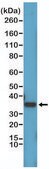 Anti-Cyclin D1 antibody, Rabbit monoclonal recombinant, expressed in HEK 293 cells, clone RM241, purified immunoglobulin
