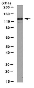 Anti-JAK2 Antibody from rabbit