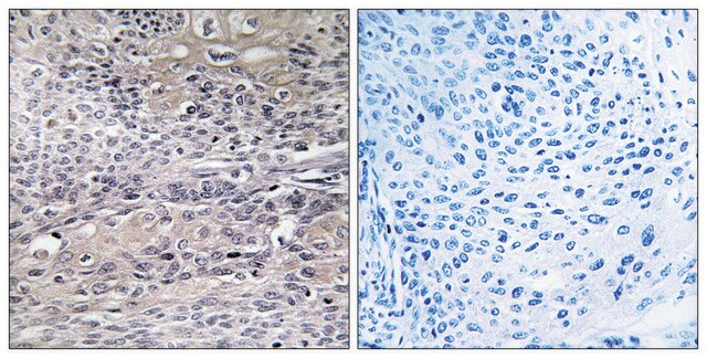 Anti-IREB1 antibody produced in rabbit affinity isolated antibody