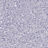 Anti-CD1A antibody produced in rabbit Prestige Antibodies&#174; Powered by Atlas Antibodies, affinity isolated antibody, buffered aqueous glycerol solution