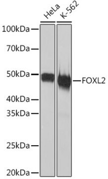 Anti-FOXL2 Antibody, clone 4H5X3, Rabbit Monoclonal