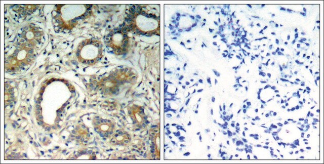 Anti- pTyr580 antibody produced in rabbit affinity isolated antibody