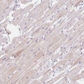 Anti-CACNA1S antibody produced in rabbit Prestige Antibodies&#174; Powered by Atlas Antibodies, affinity isolated antibody, buffered aqueous glycerol solution
