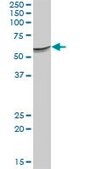 Anti-SERPINF2 antibody produced in mouse purified immunoglobulin, buffered aqueous solution