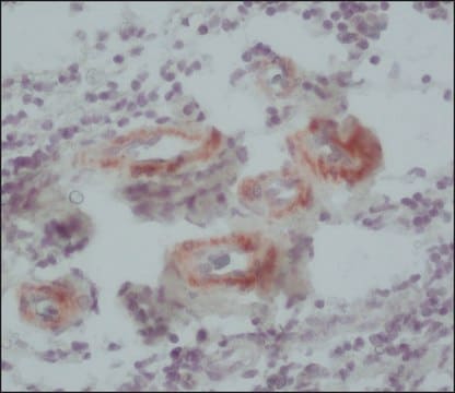 Monoclonal Anti-Calponin antibody produced in mouse clone hCP, ascites fluid