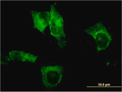 Monoclonal Anti-CEL antibody produced in mouse clone 3C8, purified immunoglobulin, buffered aqueous solution