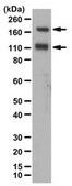 Anti-IGF-IR&#945; subunit Antibody from chicken, purified by affinity chromatography