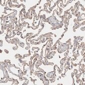 Anti-CAPN2 antibody produced in rabbit Prestige Antibodies&#174; Powered by Atlas Antibodies, affinity isolated antibody, buffered aqueous glycerol solution