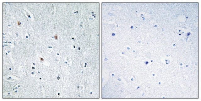 Anti-SOX12 antibody produced in rabbit affinity isolated antibody