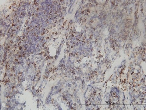 Monoclonal Anti-MTHFD2 antibody produced in mouse clone 4G7-2G3, purified immunoglobulin, buffered aqueous solution