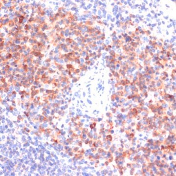 Anti-Phospho-NF-kB p65-S311 antibody produced in rabbit