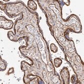 Anti-CTNNB1 antibody produced in rabbit Prestige Antibodies&#174; Powered by Atlas Antibodies, affinity isolated antibody, buffered aqueous glycerol solution, ab2