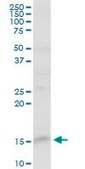Anti-FABP5 antibody produced in rabbit purified immunoglobulin, buffered aqueous solution