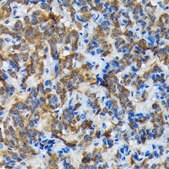 Anti-Thyroid Peroxidase Antibody, clone 3C4A4, Rabbit Monoclonal
