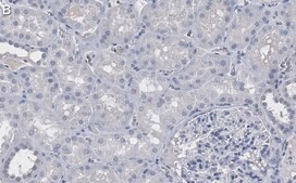 Anti-Vinculin Antibody, clone 7F9 ZooMAb&#174; Mouse Monoclonal recombinant, expressed in HEK 293 cells