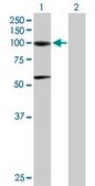 Anti-ACO1 antibody produced in mouse purified immunoglobulin, buffered aqueous solution