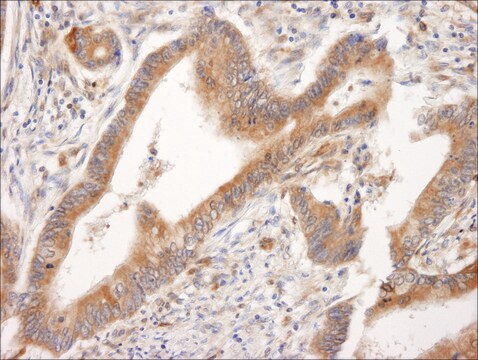 Rabbit anti-PML Antibody, Affinity Purified Powered by Bethyl Laboratories, Inc.