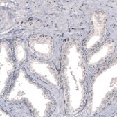 Monoclonal Anti-NIFK antibody produced in mouse Prestige Antibodies&#174; Powered by Atlas Antibodies, clone CL2240, purified immunoglobulin, buffered aqueous glycerol solution