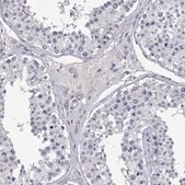 Anti-SLC1A1 antibody produced in rabbit Prestige Antibodies&#174; Powered by Atlas Antibodies, affinity isolated antibody, buffered aqueous glycerol solution