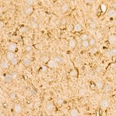 Anti-PI3 Kinase p85 alpha Antibody, clone 7Z9H0, Rabbit Monoclonal