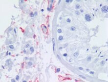 Monoclonal Anti-CD271, purified produced in mouse