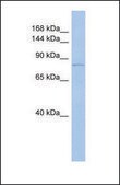 Anti-TRPV4 antibody produced in rabbit affinity isolated antibody