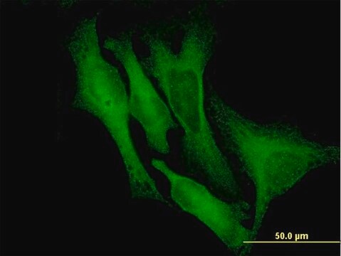 Monoclonal Anti-DCX antibody produced in mouse clone 1G12, purified immunoglobulin, buffered aqueous solution