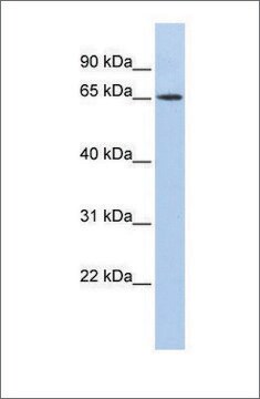 Anti-WT1 antibody produced in rabbit affinity isolated antibody