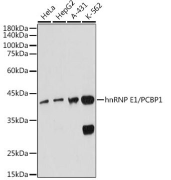 Anti-hnRNP E1/PCBP1 Antibody, clone 7M1K0, Rabbit Monoclonal