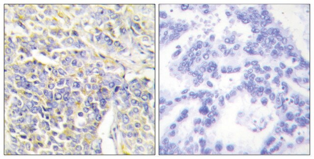 Anti-KAD1 antibody produced in rabbit affinity isolated antibody