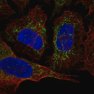 Anti-KCNAB3 antibody produced in rabbit Prestige Antibodies&#174; Powered by Atlas Antibodies, affinity isolated antibody