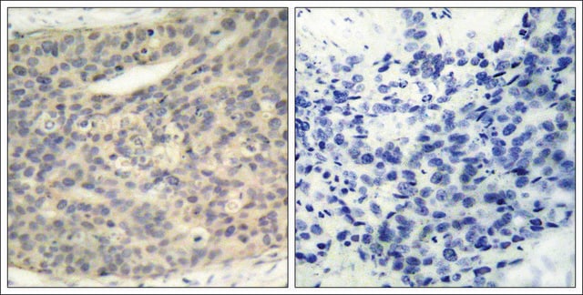 Anti-phospho-LIMK1 (pThr508) antibody produced in rabbit affinity isolated antibody