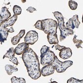 Anti-ACKR2 antibody produced in rabbit Prestige Antibodies&#174; Powered by Atlas Antibodies, affinity isolated antibody, buffered aqueous glycerol solution