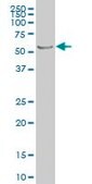 Monoclonal Anti-PTEN antibody produced in mouse clone 3E7, purified immunoglobulin, buffered aqueous solution