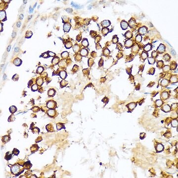 Anti-Calmegin antibody produced in rabbit